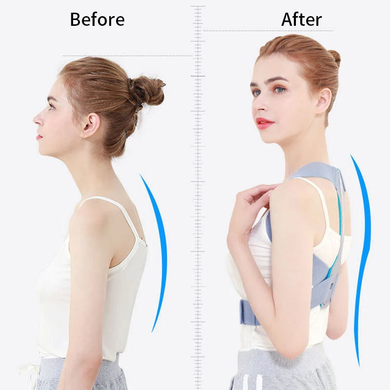 Adjustable Back Brace Posture Corrector - Customizable Back Support Belt for All-Day Comfort